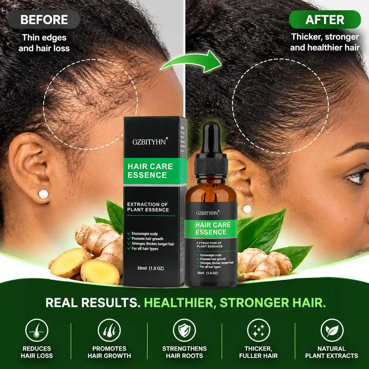Ginger Hair Oil — photo ginger-gallery-02.webp
